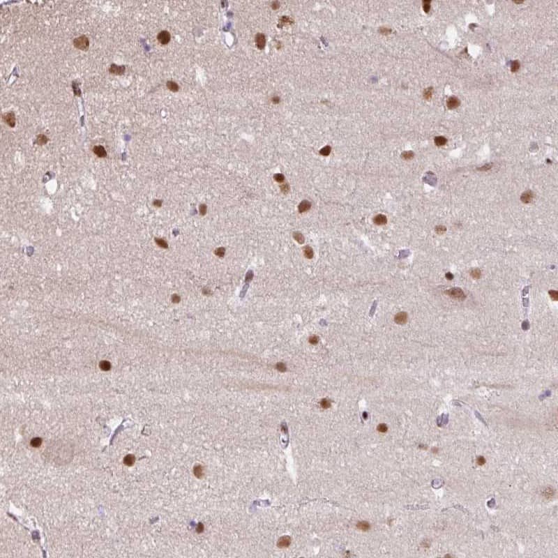 Immunohistochemistry-Paraffin TAF148 Antibody - BSA Free