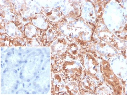 Formalin-fixed, paraffin-embedded human kidney stained with Transgelin/TAGLN/SM22 alpha antibody (TAGLN/247). Inset: PBS instead of primary antibody; secondary only negative control.