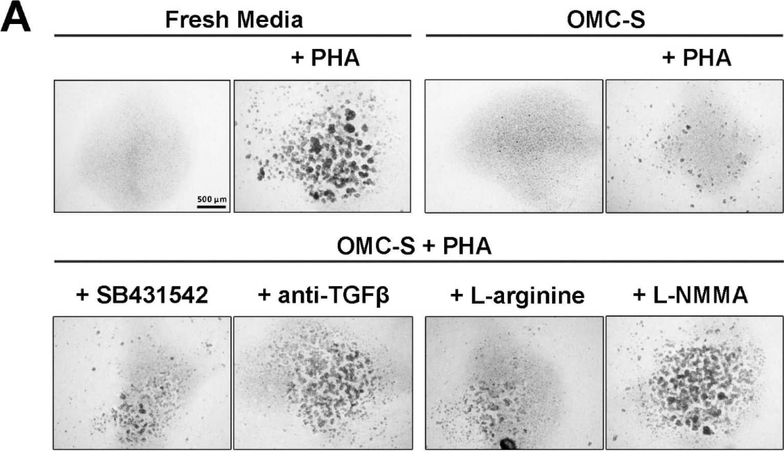 Lymphosuppression of OMC-derived secretome is partially mediated through TGF beta , L-arginine, and induction of nitric oxide synthase (NOS) in lymphocytes. (A). Upper panels, low-magnification (2×) images of mouse lymph nodes (LN) lymphocytes cultured for 48 h in fresh media or OMC-derived secretome (OMC-S), with or without 25 ug/mL phytohemagglutinin (PHA). Scale bar: 500 um. Lower panel, images of mouse LN lymphocytes cultured in the presence of OMC-S + PHA supplemented with 50 uM SB-431542 (selective inhibitor of ALK5/TGF-beta 1 Receptor), 1 ug/mL of a mouse monoclonal anti-TGF-  beta 1,  beta 2, and  beta 3 antibody, 1 mM L-arginine, or 100 uM L-NMMA (specific inhibitor of nitric oxide synthase). (B) Quantification of lymphocyte agglutination in response to the various experimental culture conditions by measuring mean particle size surface (um2). Results shown are mean +/- s.e.m from (n = 3) distinct batches of OMC-S from ALIC1, SEV3, and SEV4. Statistical differences between experimental conditions were calculated using one way ANOVA. * is for p ≤ 0.05; ** for p ≤ 0.01; *** p ≤ 0.001. Image collected and cropped by CiteAb from the following open publication (//pubmed.ncbi.nlm.nih.gov/35682603), licensed under a CC-BY license. Not internally tested by Novus Biologicals.