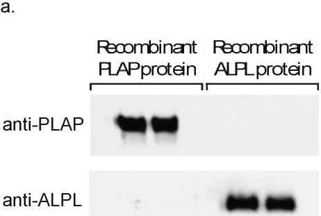Validation of EV-CATCHER customized antibodies and characterization of placental EVs. (a). Western blots displaying the specificity of the monoclonal placental alkaline phosphatase antibody against the PLAP recombinant protein (Novus, Centennial, CO, USA, #NBP2-52266) used for EV-CATCHER customization versus the alkaline phosphatase, tissue-nonspecific isozyme antibody against the ALPL recombinant protein (Novus, Centennial, CO, USA, #2909-AP-010). (b). EV-CATCHER assay customized with an anti-PLAP antibody conjugated to a uracilated DNA linker that is connected by a biotin to the bottom of a streptavidin coated well. Using uracil DNA glycosylase (UNG), the immobilized EV-anti-PLAP duplex is released by enzymatic digestion of the double-stranded uracilated DNA linker. (c). Representative Transmission electron microscopy (TEM) images of EVs isolated from placenta previa and placenta percreta maternal plasma, scale bar 100 um. (d). Representative ONi super resolution images of EVs isolated from placenta previa and placenta percreta maternal plasma displaying both high PLAP+ expressing EVs and low PLAP+ expressing EVs, scale bar of 20 um for large field-of-view images and 200 nm for individual representative EVs. Image collected and cropped by CiteAb from the following open publication (//pubmed.ncbi.nlm.nih.gov/38791142), licensed under a CC-BY license. Not internally tested by Novus Biologicals.