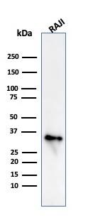 Western Blot Analysis of Raji cell lysate using CD74 Antibody (CLIP/813) - IHC-Prediluted
