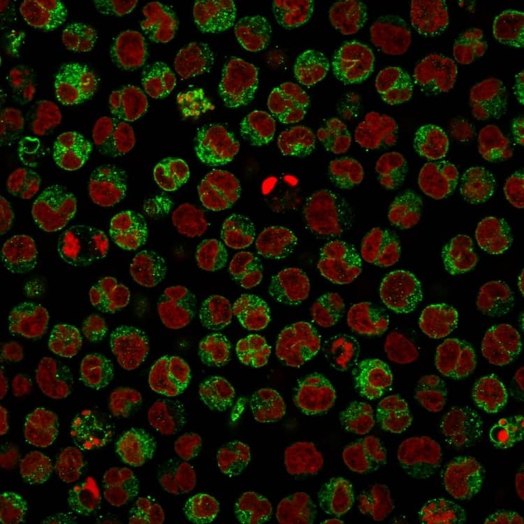 Immunofluorescence Analysis of Raji cells. CD79A Antibody (IGA/764) - IHC-Prediluted The nuclear counterstain is Reddot (Red)