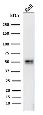 Western Blot Analysis of human Raji cell lysate using CD79A Antibody (IGA/764) - IHC-Prediluted.