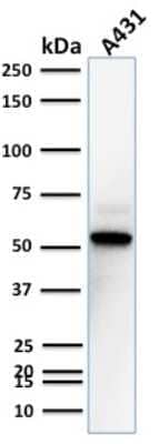 Western Blot: TOX3 Antibody (TOX3/1123) - IHC-Prediluted [NBP2-48059] - Western Blot Analysis of A431 cell lysate using TOX3 Mouse Monoclonal Antibody (TOX3/1123).