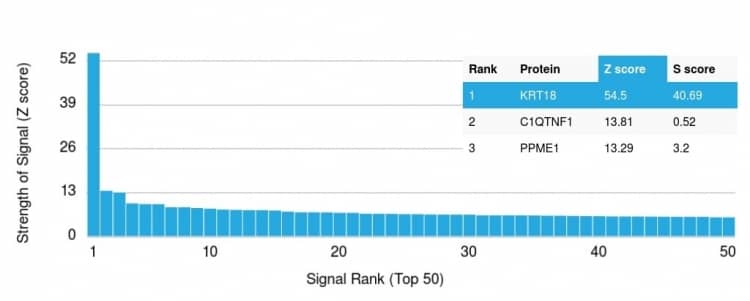 Analysis of Protein Array containing >19,000 full-length human proteins using Cytokeratin 18 Antibody (KRT18/836) - IHC-Prediluted Z- and S- Score: The Z-score represents the strength of a signal that a monoclonal antibody (MAb) (in combination with a fluorescently-tagged anti-IgG secondary antibody) produces when binding to a particular protein on the HuProtTM array. Z-scores are described in units of standard deviations (SD's) above the mean value of all signals generated on that array. If targets on HuProtTM are arranged in descending order of the Z-score, the S-score is the difference (also in units of SD's) between the Z-score. S-score therefore represents the relative target specificity of a MAb to its intended target. A MAb is considered to specific to its intended target, if the MAb has an S-score of at least 2.5. For example, if a MAb binds to protein X with a Z-score of 43 and to protein Y with a Z-score of 14, then the S-score for the binding of that MAb to protein X is equal to 29.