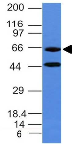 Western Blot of human Chromogranin A Antibody (CHGA/777) - IHC-Prediluted