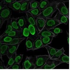 Immunofluorescence staining of PFA-fixed HeLa cells using H1F0 Antibody (AE-4) - IHC-Prediluted followed by goat anti-mouse IgG-CF488 (green). Membrane stained by Phalloidin