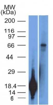 Western Blot: TRIM29 Antibody (TRIM29/1042) - IHC-Prediluted [NBP2-48094] - TRIM29 Recombinant protein fragment & A431 Cell Lysate TRIM29 Monoclonal Antibody (TRIM29/1042).