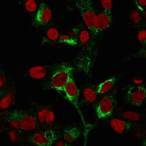 Immunofluorescence Analysis of PFA-fixed HepG2 cells labeling AFP using alpha-Fetoprotein/AFP Antibody (C2 + C3 + MBS-12) - IHC-Prediluted followed by Goat anti-Mouse IgG-CF488 (Green). The nuclear counterstain is Redot.