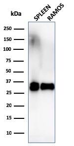 Western Blot Analysis of Ramos cells and human spleen tissue lysate using HLA DRB1 Antibody (SPM289) - IHC-Prediluted.