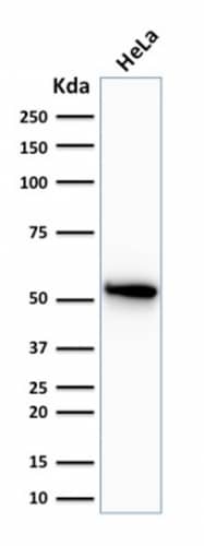 Western Blot Analysis of human HeLa cell lysate using Cytokeratin 7 Antibody (OV-TL12/30) - IHC-Prediluted.