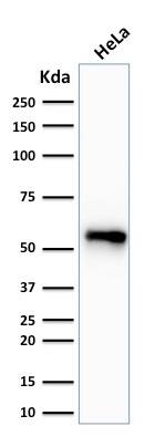 Western Blot Analysis of human HeLa cell lysate using Cytokeratin 7 Antibody (SPM270) - IHC-Prediluted.