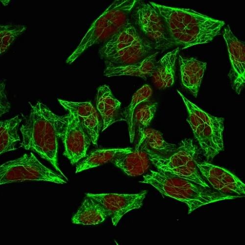 Immunofluorescence Analysis of HeLa cells labeling Cytokeratin 7 with Cytokeratin 7 Antibody (SPM270) - IHC-Prediluted followed by Goat anti-Mouse IgG-CF488 (Green). The nuclear counterstain is Reddot (Red).