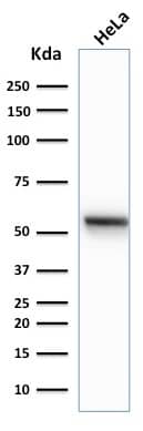 Western Blot Analysis of human HeLa cell lysate using Cytokeratin 7 Antibody (K72.7) - IHC-Prediluted.