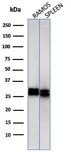 Western Blot Analysis of Ramos cell and human spleen tissue lysate using HLA DRB1 Antibody (HLA-DRB/1067) - IHC-Prediluted.