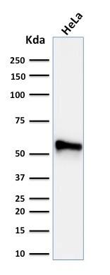 Western Blot Analysis of human HeLa cell lysate using Cytokeratin 7 Antibody (KRT7/760 + KRT7/903) - IHC-Prediluted.