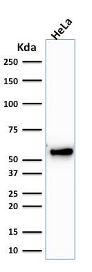 Western Blot Analysis of human HeLa cell lysate using Cytokeratin 7 Antibody (KRT7/1198) - IHC-Prediluted.