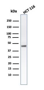 Western Blot analysis of HCT116 cell lysate using Cytokeratin 8 Antibody (B22.1) - IHC-Prediluted.