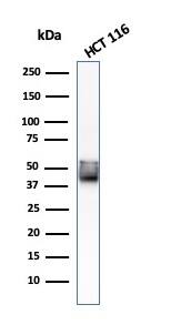 Western Blot Analysis of HCT116 cell lysate using CK8 with Cytokeratin 8 Antibody (KRT8/803) - IHC-Prediluted.