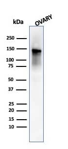 Western Blot Analysis of human Ovary tissue lysate using Caldesmon/CALD1 Antibody (SPM168) - IHC-Prediluted.