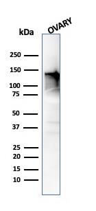 Western Blot Analysis of human Ovary tissue using Caldesmon/CALD1 Antibody (CALD1/820) - IHC-Prediluted.