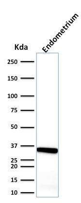 Western Blot Analysis of endometrium using Calponin 1 Antibody (CALP) - IHC-Prediluted.