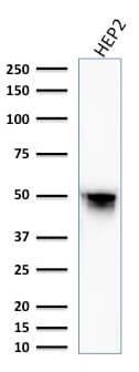Western Blot Analysis of HEP2 cell lysate using Vimentin Antibody (VM1170) - IHC-Prediluted.