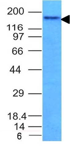 Western Blot Analysis of HCT116 cell lysate using NCAM-1/CD56 Antibody (NCAM1/795) - IHC-Prediluted.