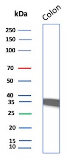 Western Blot Analysis of Colon lysate using Calponin 1 Antibody (CNN1/832) - IHC-Prediluted.