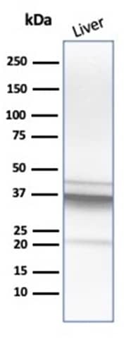 Western Blot Analysis of human liver tissue lysate using Arginase 1/ARG1/liver Arginase Antibody (ARG1/1125) - IHC-Prediluted.