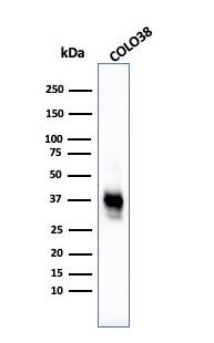Western Blot Analysis of COLO38 cell lysate using Melanoma Marker (MART-1 + Tyrosinase + gp100) Antibody (M2-7C10 + M2-9E3 + T311 + HMB45) - IHC-Prediluted.