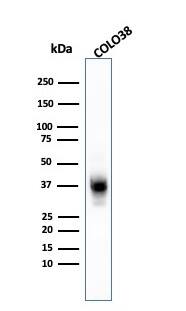 Western Blot Analysis of COLO-38 cell lysate using Melanoma Marker (MART-1 + Tyrosinase + gp100) Antibody (A103 + T311 + HMB45) - IHC-Prediluted.