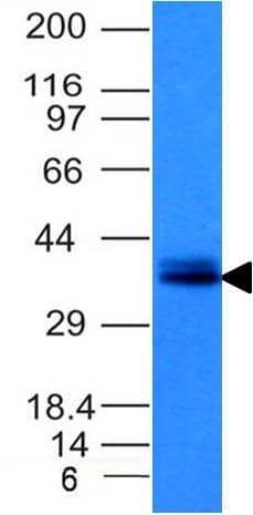Western Blot Analysis of HCT116 cell lysate (Non-reducing) using EpCAM/TROP1 Antibody (EGP40/1120) - (ECD) - IHC-Prediluted