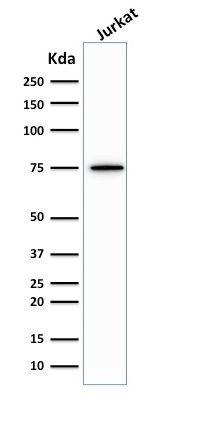 Western Blot Analysis of human Jurkat cell lysate using Moesin Antibody (MSN/492) - IHC-Prediluted.