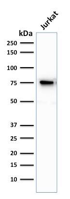 Western Blot Analysis of human Jurkat cell lysate. Moesin Antibody (MSN/493) - IHC-Prediluted.