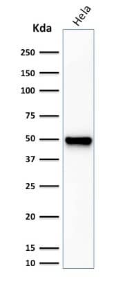 Western Blot Analysis of HeLa cell lysate using Fascin Antibody (FSCN1/416) - IHC-Prediluted.