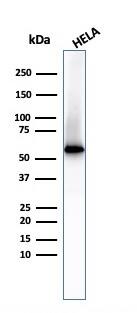 Western Blot of HeLa cell lysate Using Fascin Antibody (FSCN1/417) - IHC-Prediluted