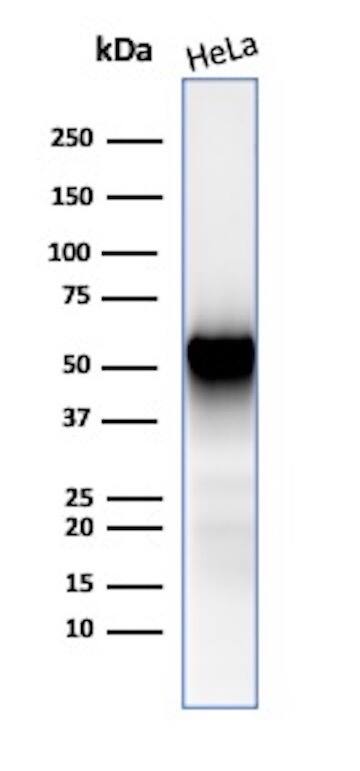 Western blot analysis of HeLa cell lysate using Fascin Antibody (FSCN1/417) - IHC-Prediluted.