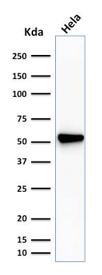 Western Blot Analysis of HeLa cell lysate Fascin Antibody (SPM133) - IHC-Prediluted