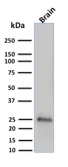 Western Blot Analysis of human brain tissue lysate using UCH-L1/PGP9.5 Antibody (UCHL1/775) - IHC-Prediluted.