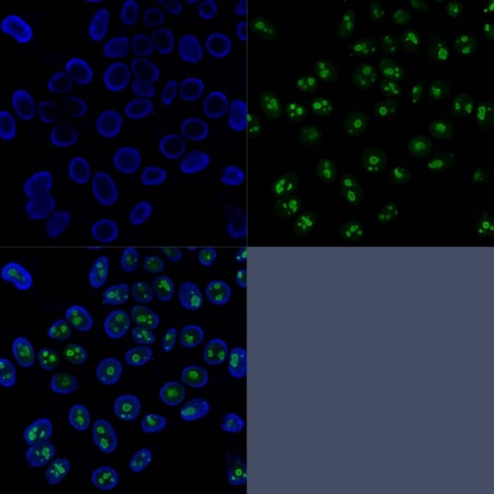 Immunofluorescence analysis of HeLa cells stained with CF647R-Nucleolin Mouse Monoclonal Antibody (SPM614) (green). Nuclei counterstained stained with Nucleolin Antibody (SPM614) - IHC-Prediluted.