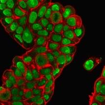 Immunofluorescence Analysis of PFA-fixed MCF-7 cells stained with Nucleolin Antibody (364-5 + NCL/902) - IHC-Prediluted followed by goat anti-mouse IgG-CF488 (green). Membrane is stained with Phalloiden-CF640.