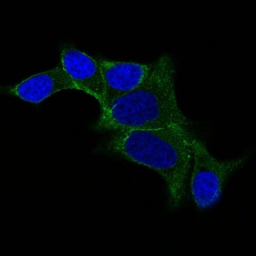 IF staining of LNCap cells using AF488 labeled Ornithine Decarboxylase Antibody (ODC1/487) - IHC-Prediluted (Green). DAPI was used to stain the cell nuclei (blue).