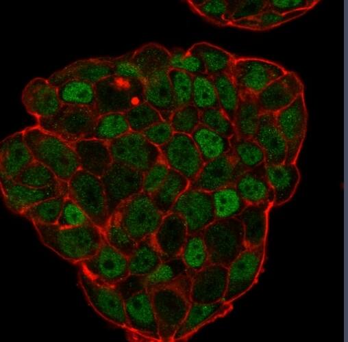 Immunofluorescence Analysis of PFA-fixed MCF-7 cells labeling p27 with p27/Kip1 Antibody (KIP1/769) - IHC-Prediluted followed by Goat anti-Mouse IgG-CF488 (Green). Membrane is stained with Phalloidin-CF640