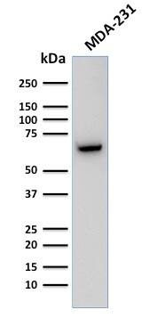 Western Blot Analysis of Human MDA-231 cell lysate using GnRHR Antibody (F1G4) - IHC-Prediluted.