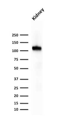Western Blot Analysis of human kidney tissue lysate using Cadherin-16 Antibody (CDH16/1071) - IHC-Prediluted.
