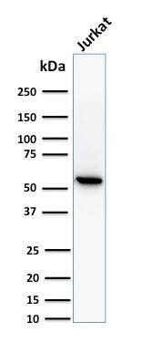 Western Blot Analysis of Jurkat cell lysate using TOP1MT Antibody (TOP1MT/488) - IHC-Prediluted.
