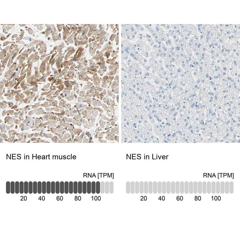 <b>Genetic Strategies Validation and Orthogonal Strategies Validation.</b>Analysis in human heart muscle and liver tissues. Corresponding RNA-seq data are presented for the same tissues.