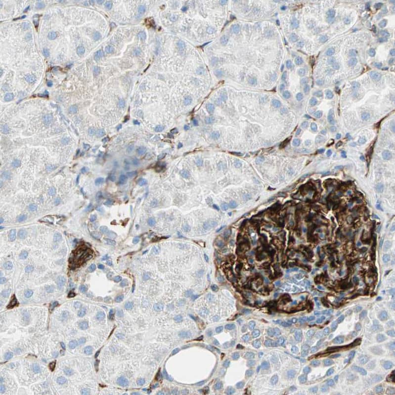 Staining of human kidney shows strong cytoplasmic positivity in cells in glomeruli.