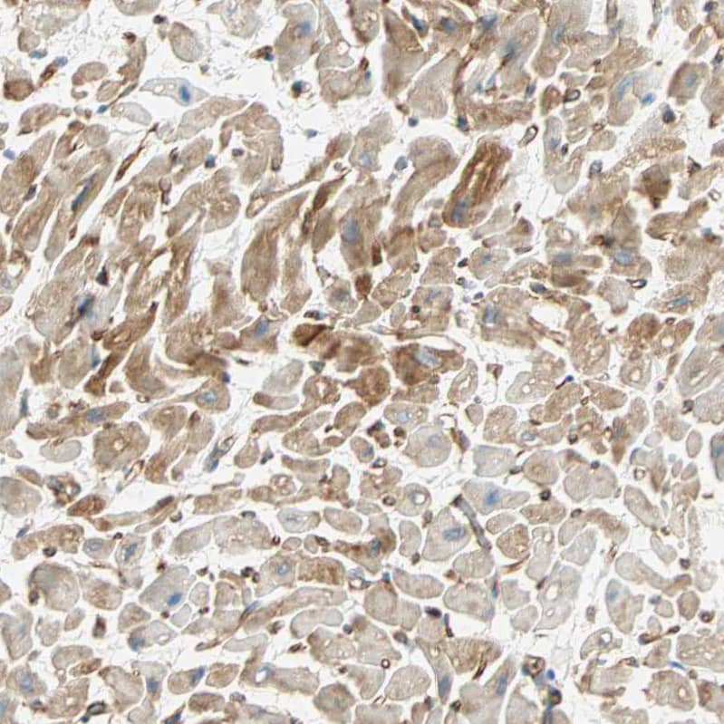 Staining of human heart muscle shows strong cytoplasmic positivity in cardiomyocytes.